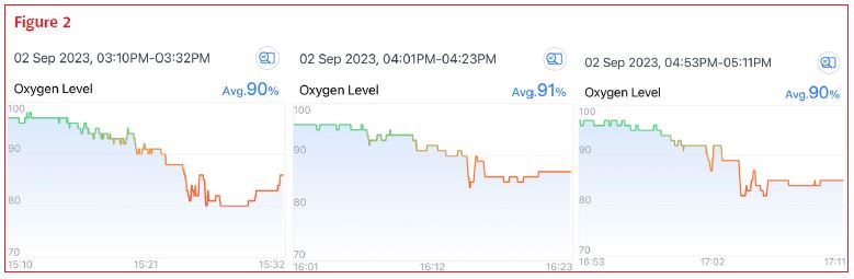 Studying Hypoxia in Skydivers