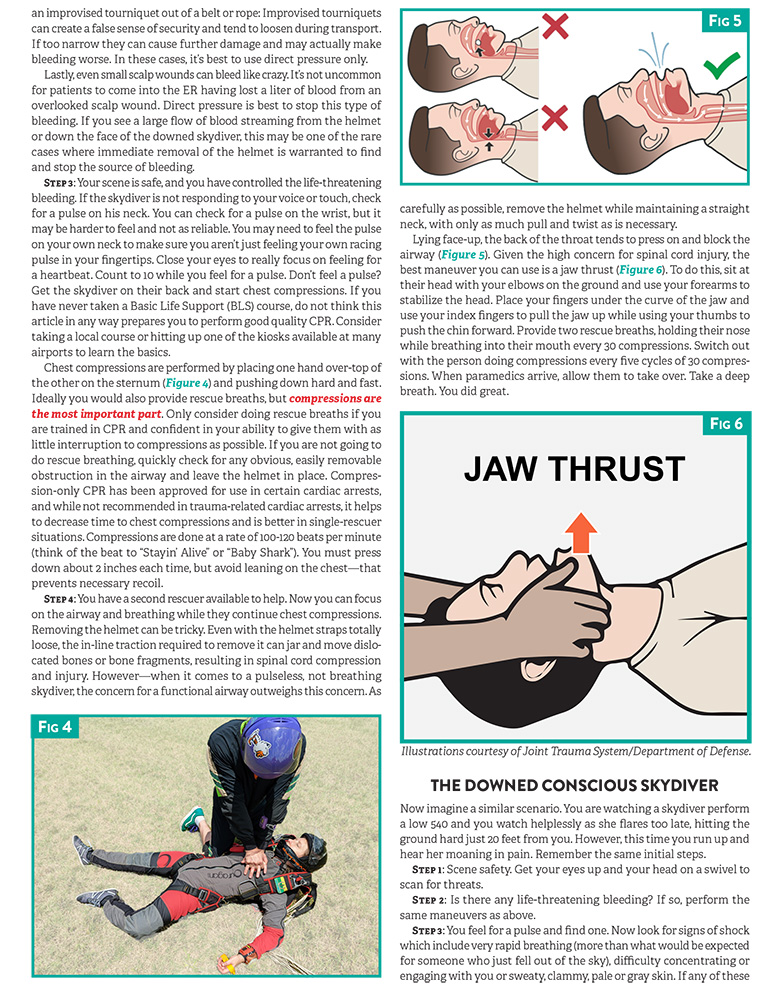 That's How We Roll: Ankle Injuries in Skydiving